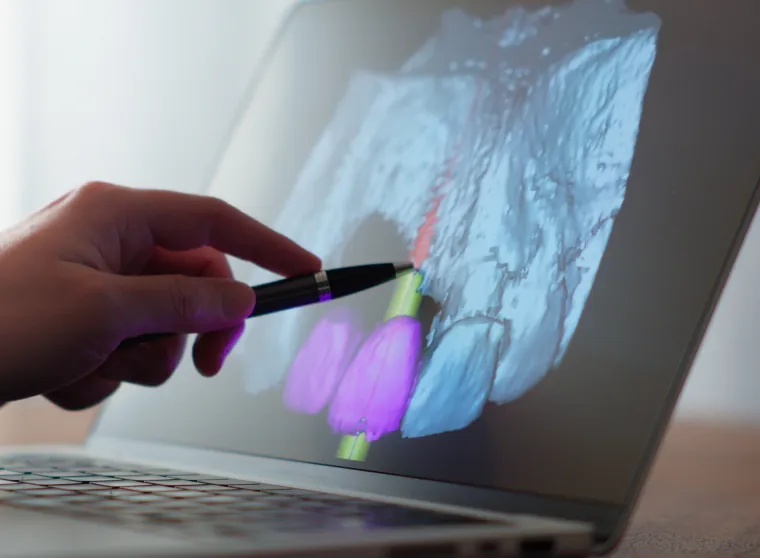 レントゲン検査