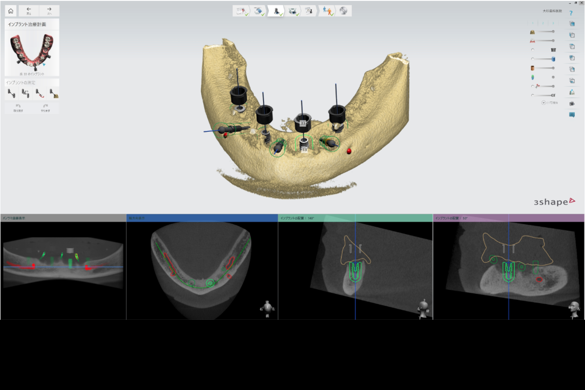 Implant Studio