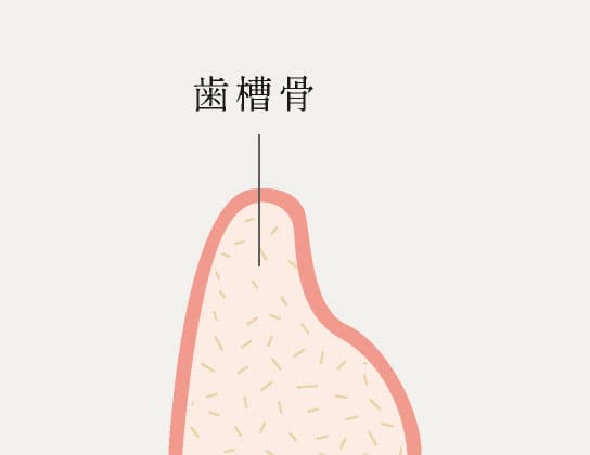 歯槽骨