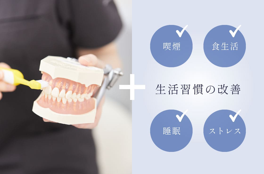 メインテナンス＋生活習慣の改善（喫煙・食生活・睡眠・ストレス）