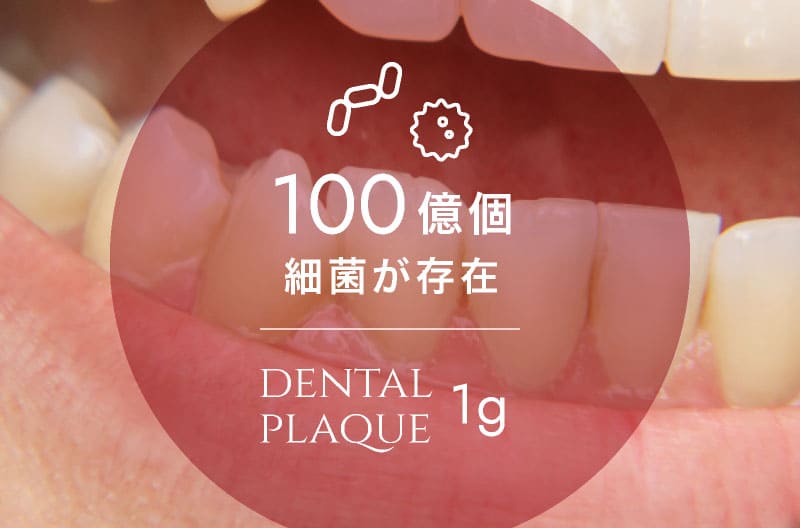 100億個細菌が存在