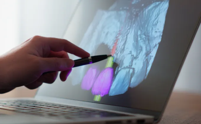 歯周病・インプラント専門外来/難症例可